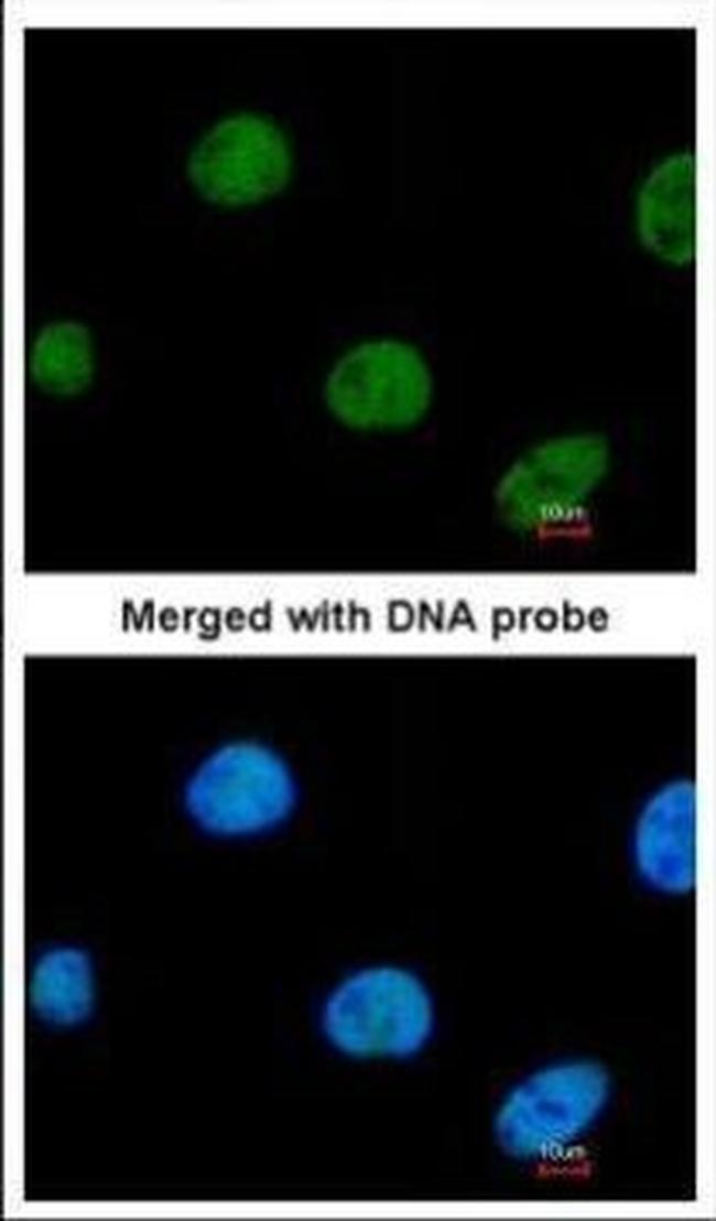 ZNF211 Antibody in Immunocytochemistry (ICC/IF)