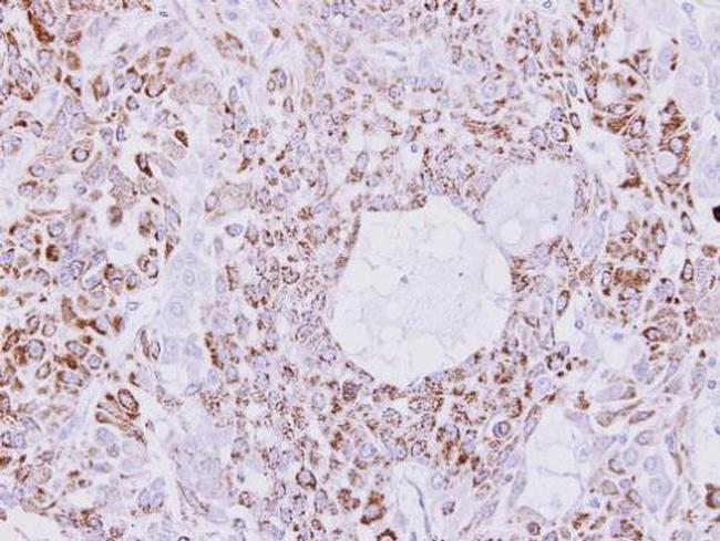 Creatine Kinase MT Antibody in Immunohistochemistry (Paraffin) (IHC (P))