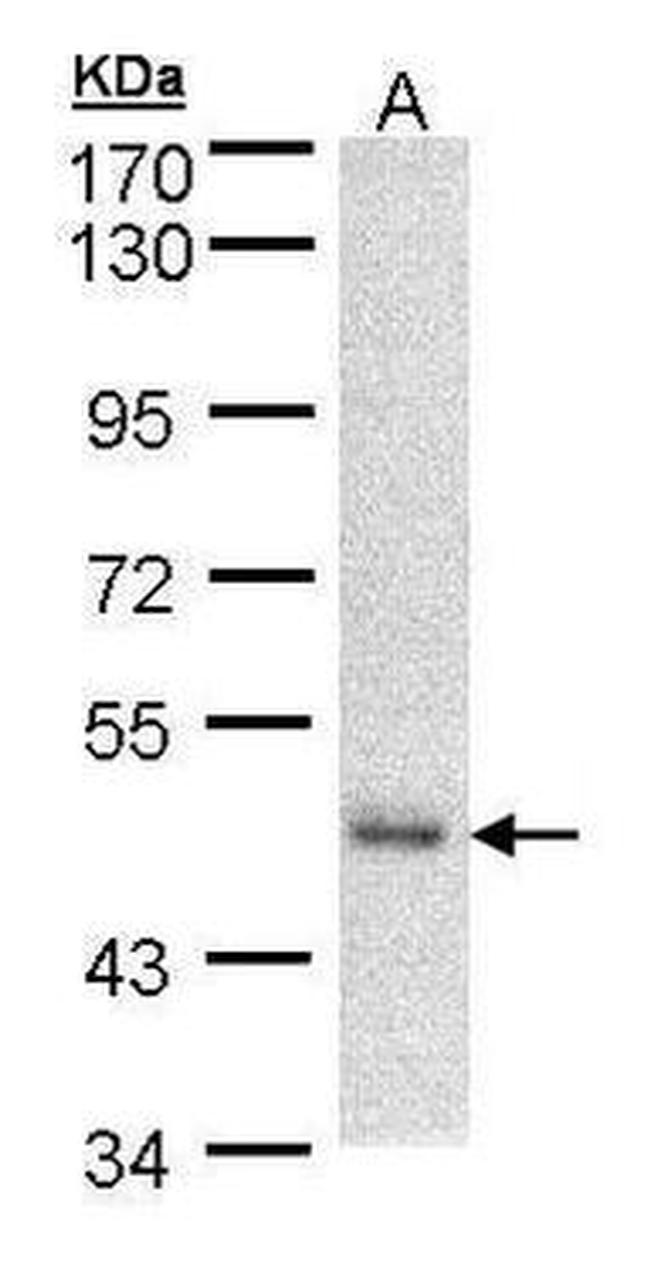 DNAJA2 Antibody in Western Blot (WB)