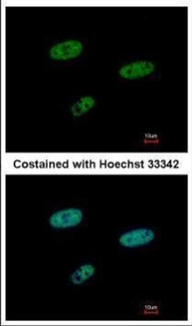 SAMHD1 Antibody in Immunocytochemistry (ICC/IF)