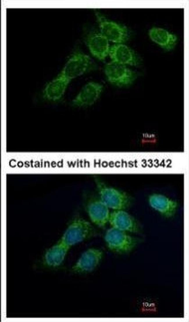 HSD17B4 Antibody in Immunocytochemistry (ICC/IF)