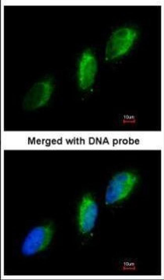 TYK2 Antibody in Immunocytochemistry (ICC/IF)