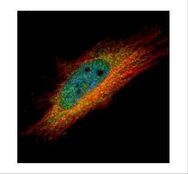 IP6K1 Antibody in Immunocytochemistry (ICC/IF)