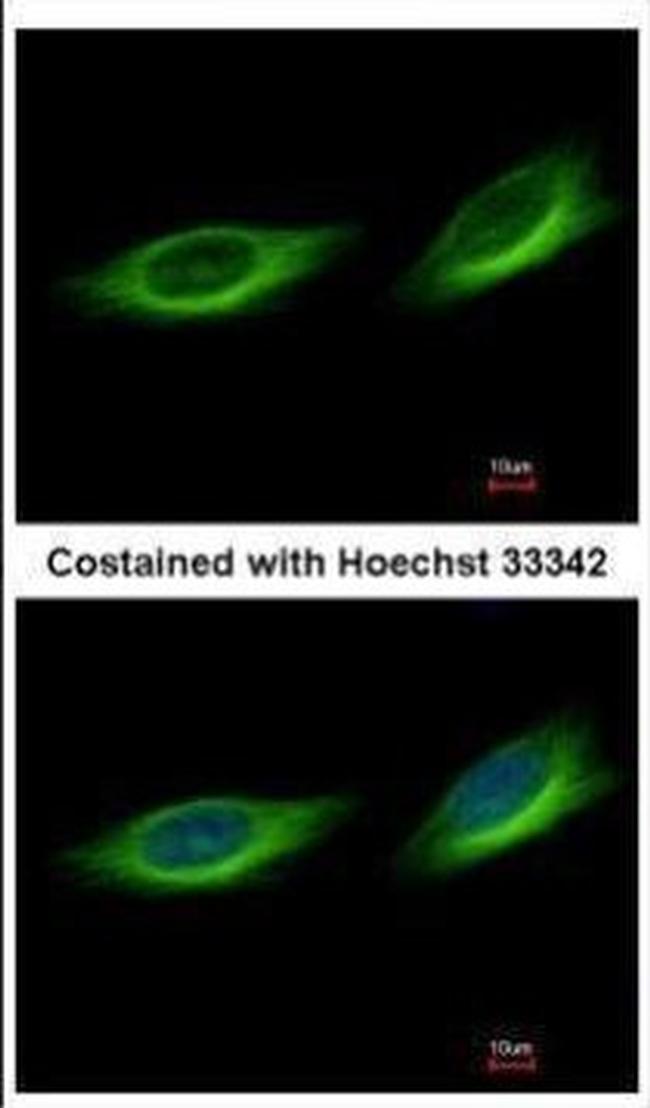 TULP1 Antibody in Immunocytochemistry (ICC/IF)