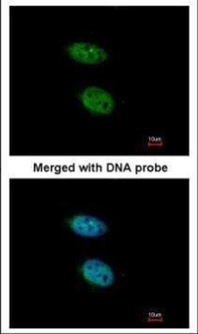 PRPS2 Antibody in Immunocytochemistry (ICC/IF)