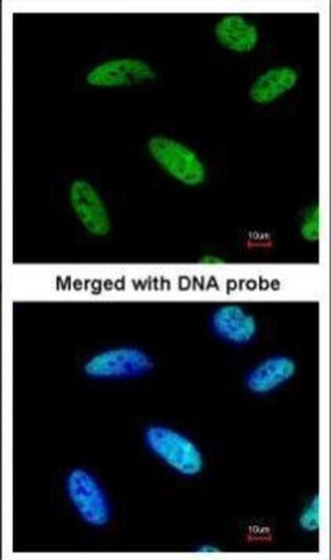 DNAJC7 Antibody in Immunocytochemistry (ICC/IF)