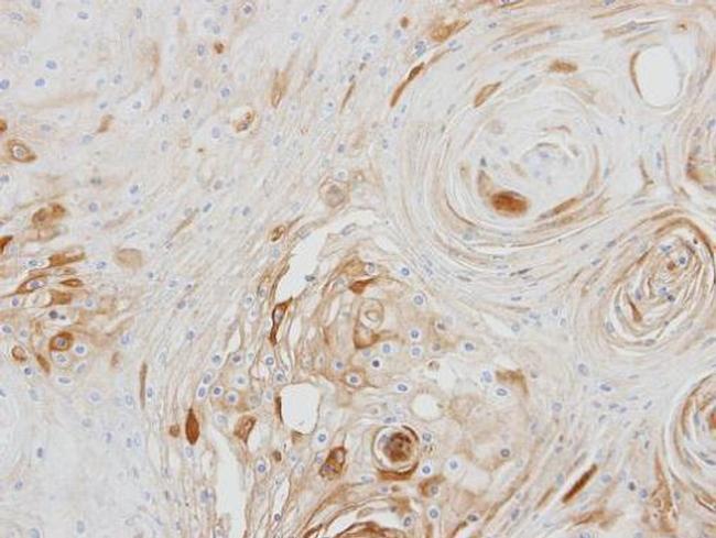 BCAT2 Antibody in Immunohistochemistry (Paraffin) (IHC (P))