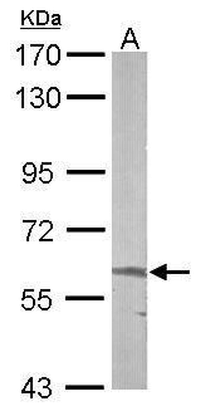 ALAS2 Antibody in Western Blot (WB)