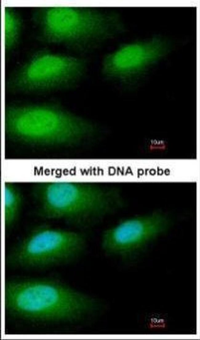 IRAK-M Antibody in Immunocytochemistry (ICC/IF)