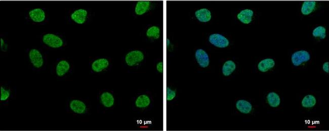 LDB1 Antibody in Immunocytochemistry (ICC/IF)