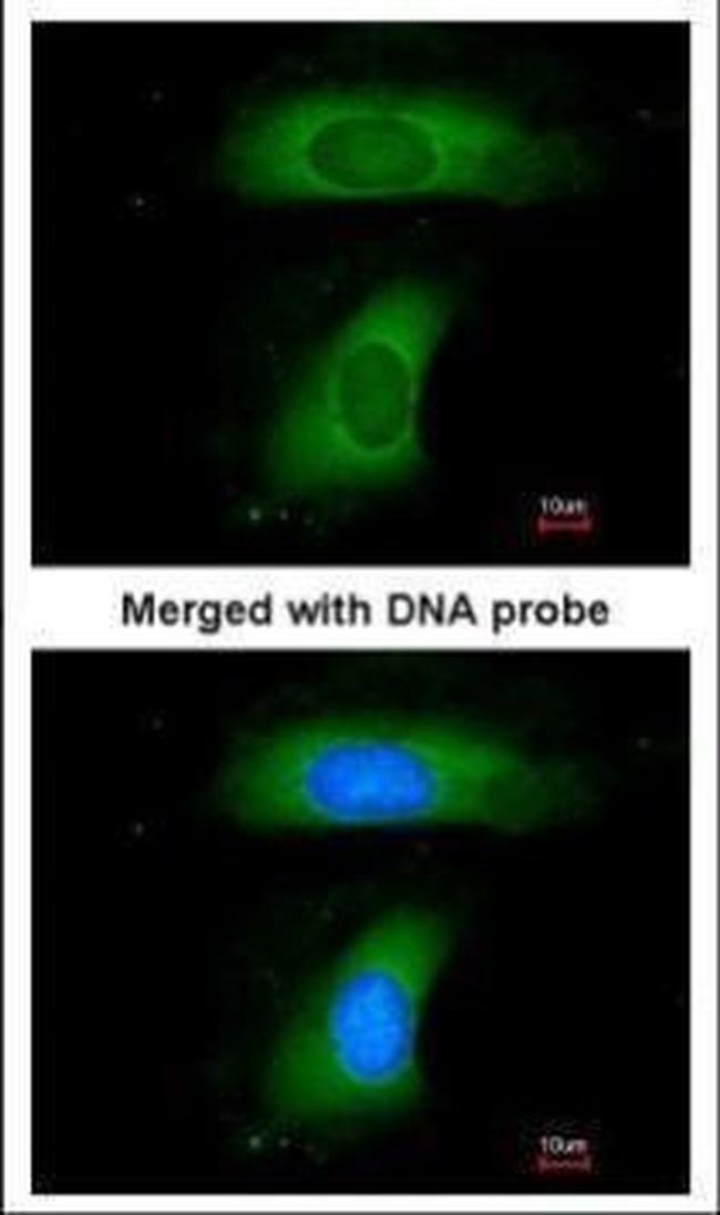 BLNK Antibody in Immunocytochemistry (ICC/IF)