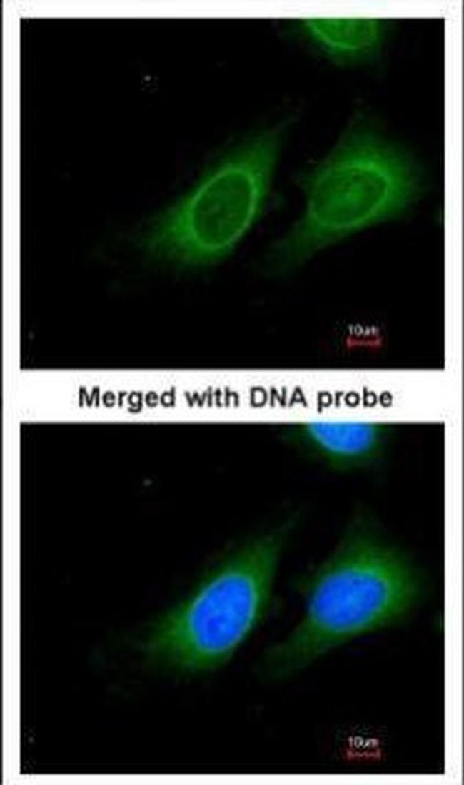 15-PGDH Antibody in Immunocytochemistry (ICC/IF)