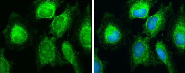 SDHB Antibody in Immunocytochemistry (ICC/IF)