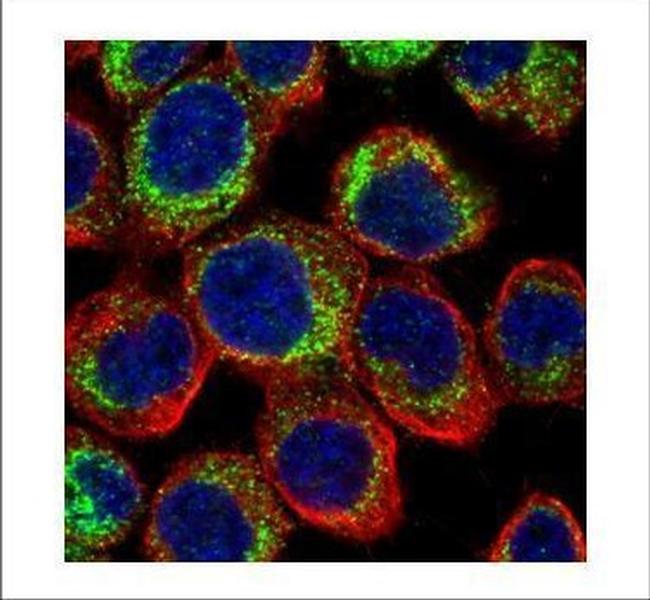 PDE4D Antibody in Immunocytochemistry (ICC/IF)