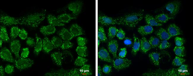 CLPP Antibody in Immunocytochemistry (ICC/IF)