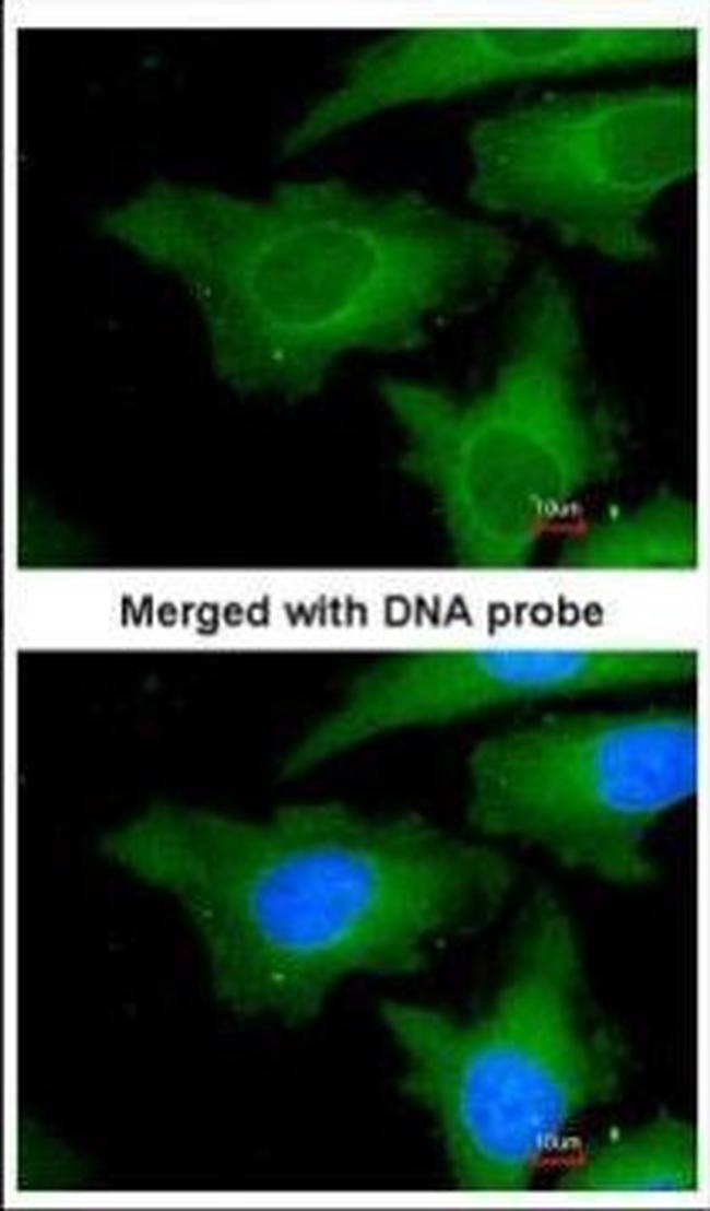 UBE2L3 Antibody in Immunocytochemistry (ICC/IF)