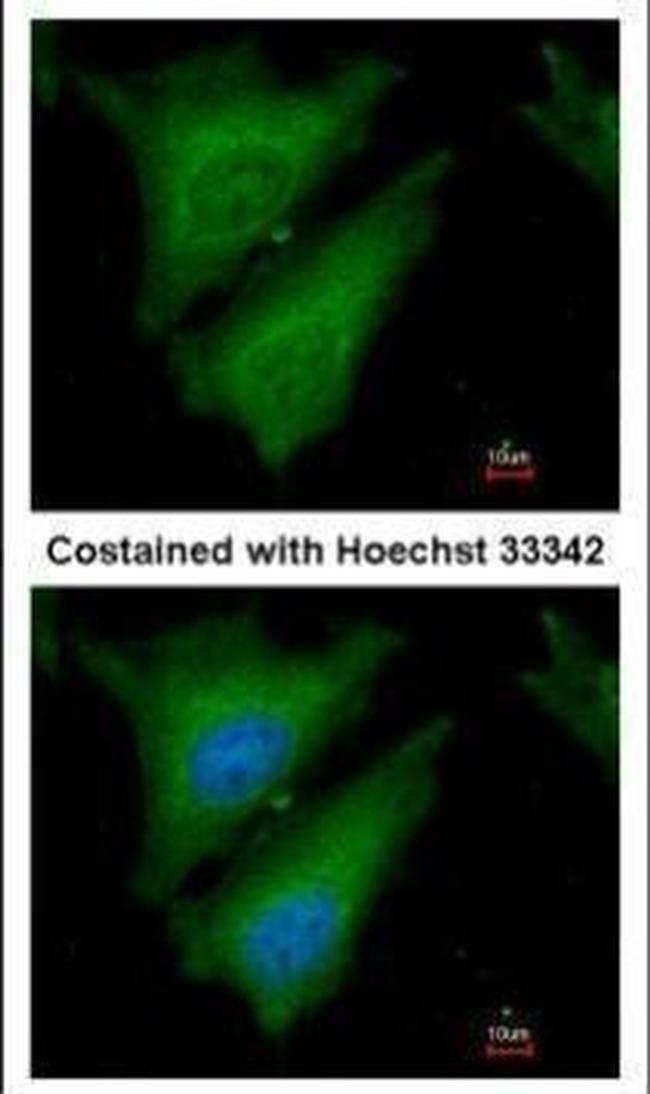 SOCS4 Antibody in Immunocytochemistry (ICC/IF)