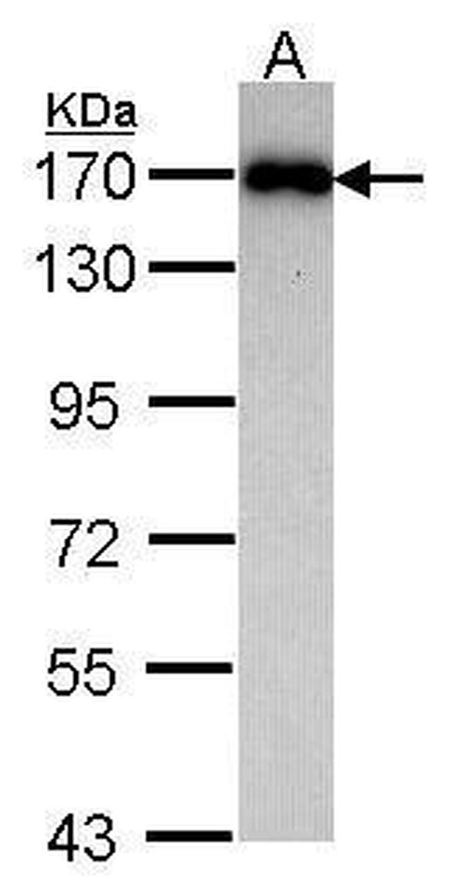 MAGI2 Antibody in Western Blot (WB)