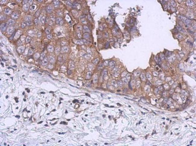 Kinesin 5B Antibody in Immunohistochemistry (Paraffin) (IHC (P))