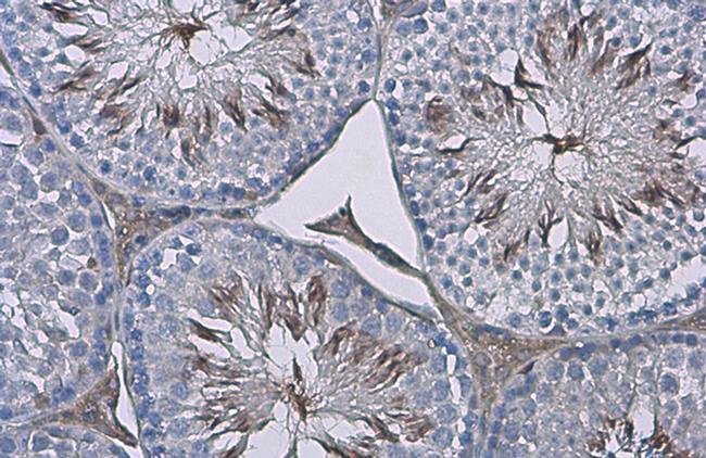 ZPBP Antibody in Immunohistochemistry (Paraffin) (IHC (P))