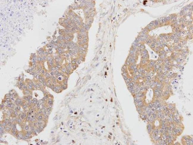 MSTO1 Antibody in Immunohistochemistry (Paraffin) (IHC (P))