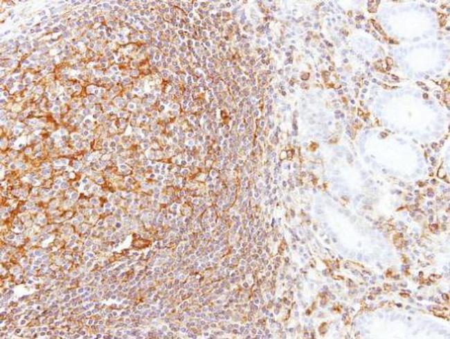 LBP Antibody in Immunohistochemistry (Paraffin) (IHC (P))