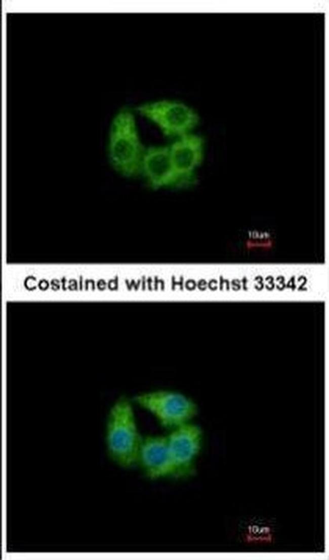 PCCB Antibody in Immunocytochemistry (ICC/IF)