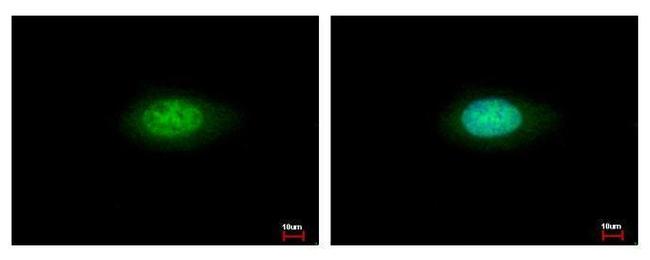 Annexin A7 Antibody in Immunocytochemistry (ICC/IF)