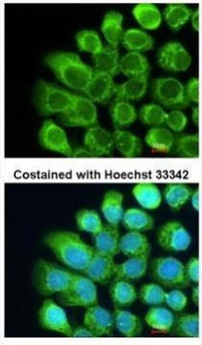 C2 Antibody in Immunocytochemistry (ICC/IF)