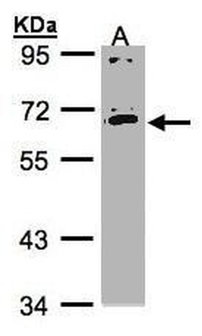 IL17RC Isoform 1 Precursor Antibody in Western Blot (WB)