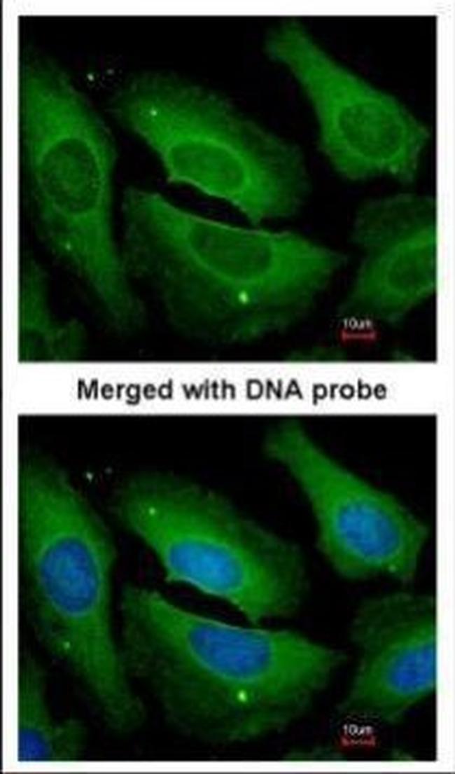 PP1 gamma Antibody in Immunocytochemistry (ICC/IF)