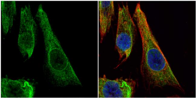 Bcl-X Antibody in Immunocytochemistry (ICC/IF)