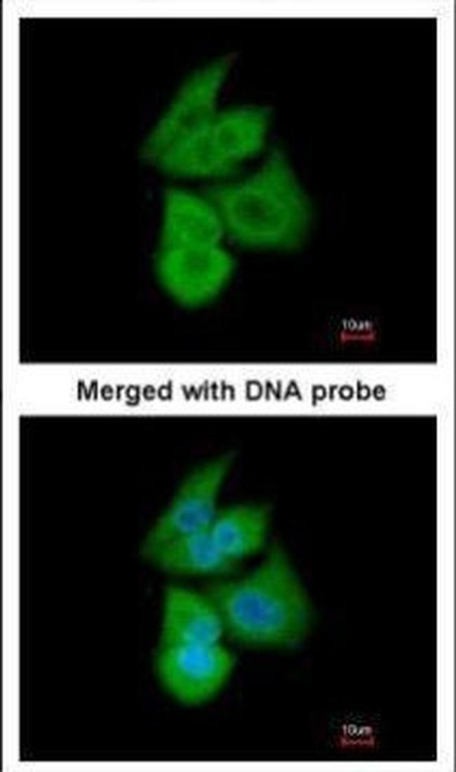 PFKL Antibody in Immunocytochemistry (ICC/IF)