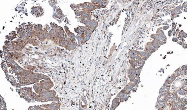 NT5C2 Antibody in Immunohistochemistry (Paraffin) (IHC (P))