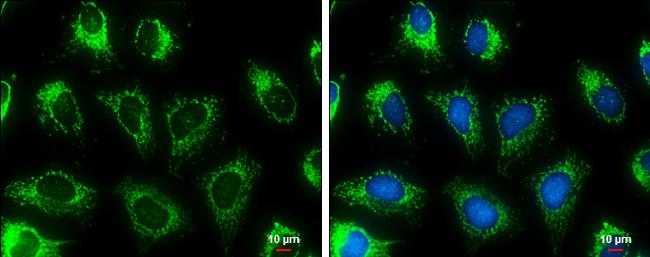 MDH2 Antibody in Immunocytochemistry (ICC/IF)