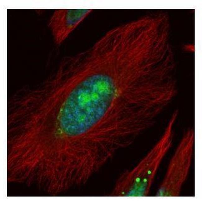 UTP6 Antibody in Immunocytochemistry (ICC/IF)