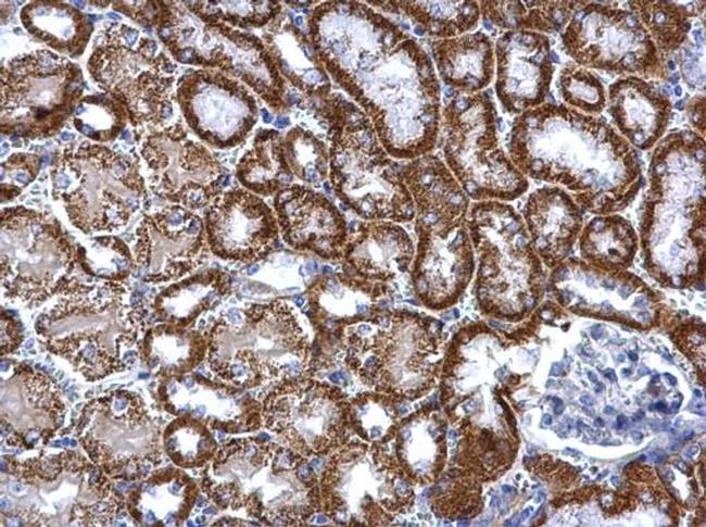 TST Antibody in Immunohistochemistry (Paraffin) (IHC (P))