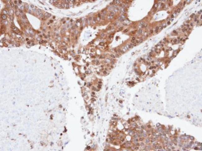 ERLIN2 Antibody in Immunohistochemistry (Paraffin) (IHC (P))