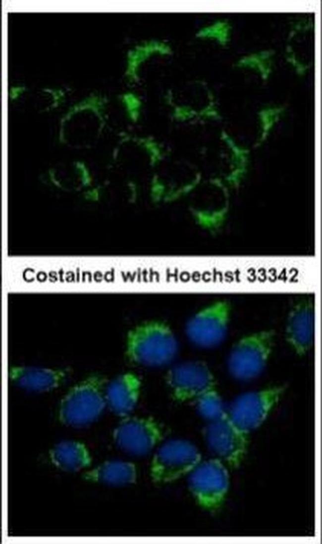 CMG1 Antibody in Immunocytochemistry (ICC/IF)