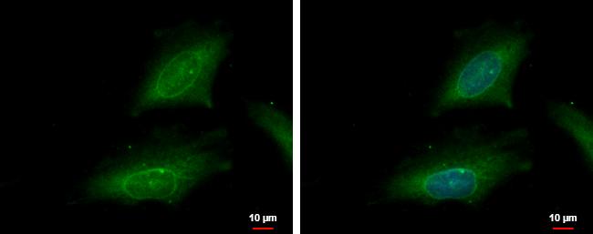 KPNA2 Antibody in Immunocytochemistry (ICC/IF)