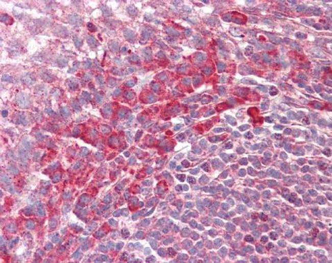 PEX13 Antibody in Immunohistochemistry (Paraffin) (IHC (P))