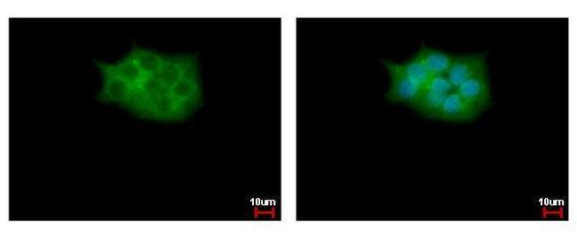 SKAP2 Antibody in Immunocytochemistry (ICC/IF)