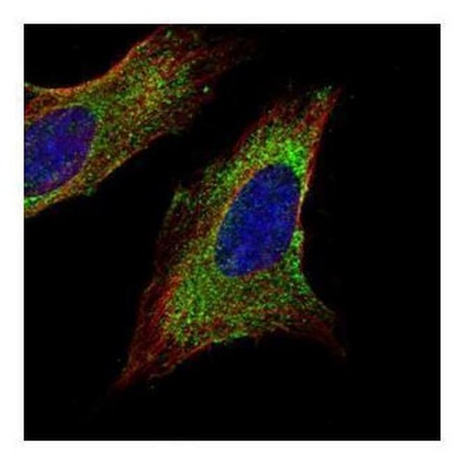 TOM1L1 Antibody in Immunocytochemistry (ICC/IF)