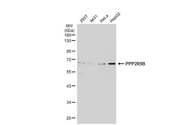 PPP2R5B Antibody in Western Blot (WB)