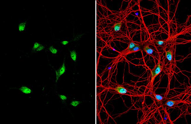 Centaurin alpha-1 Antibody in Immunocytochemistry (ICC/IF)