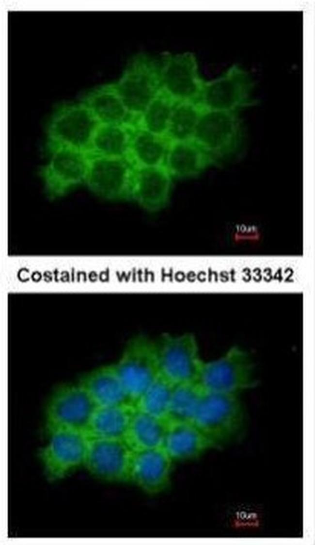 SEC61A1 Antibody in Immunocytochemistry (ICC/IF)