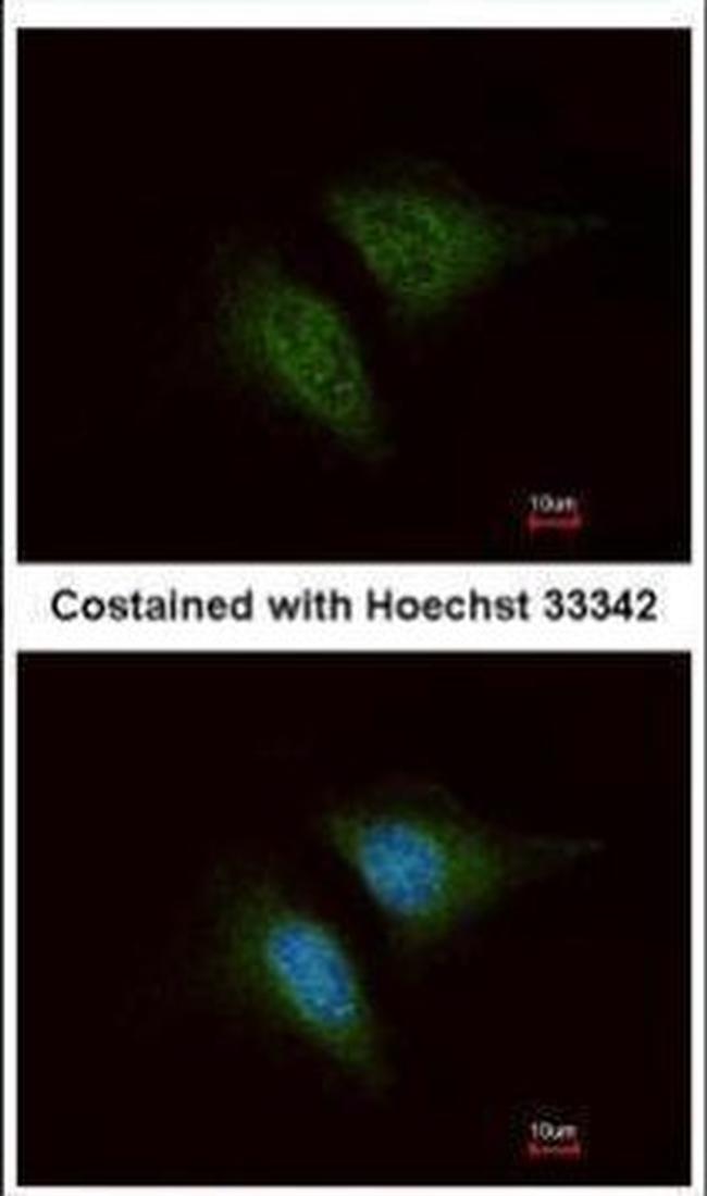 Coronin 3 Antibody in Immunocytochemistry (ICC/IF)