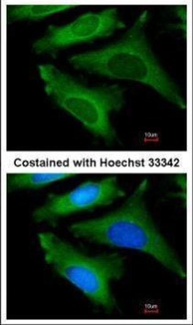 IL1RA Antibody in Immunocytochemistry (ICC/IF)