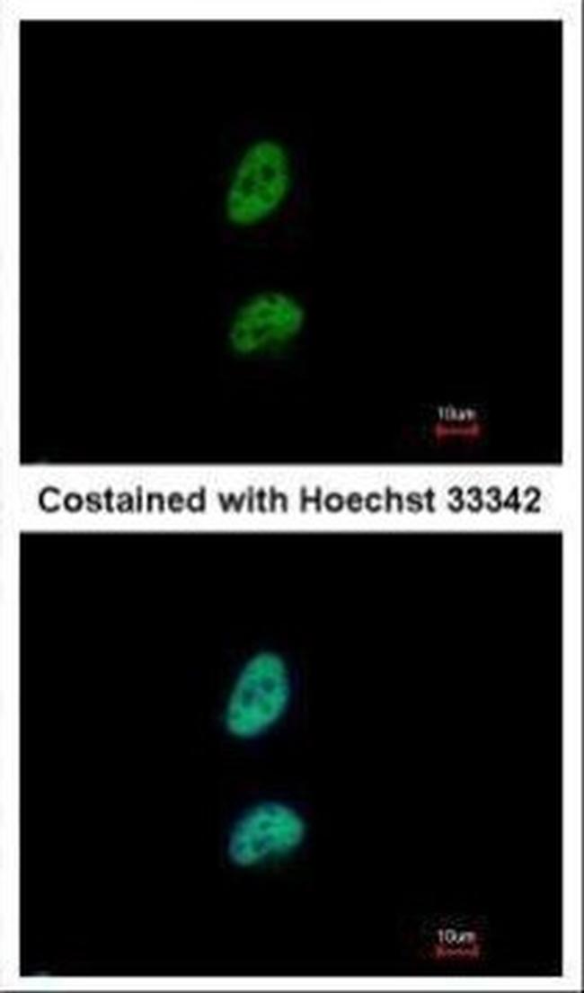 PSME3 Antibody in Immunocytochemistry (ICC/IF)