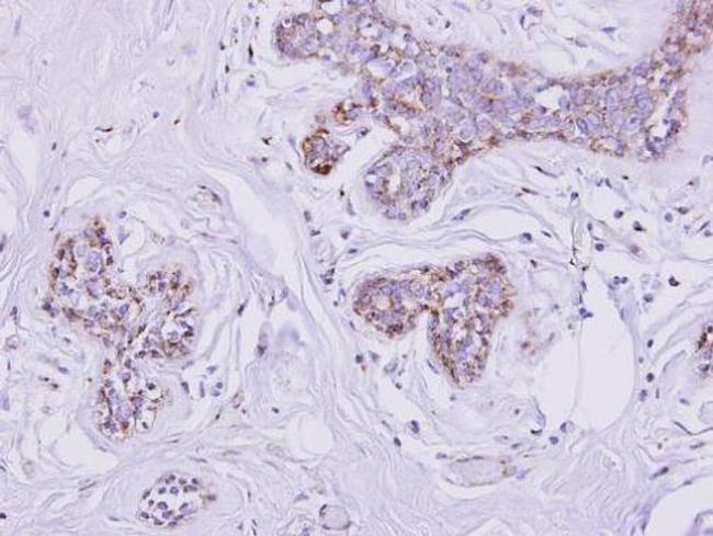 SLC25A33 Antibody in Immunohistochemistry (Paraffin) (IHC (P))